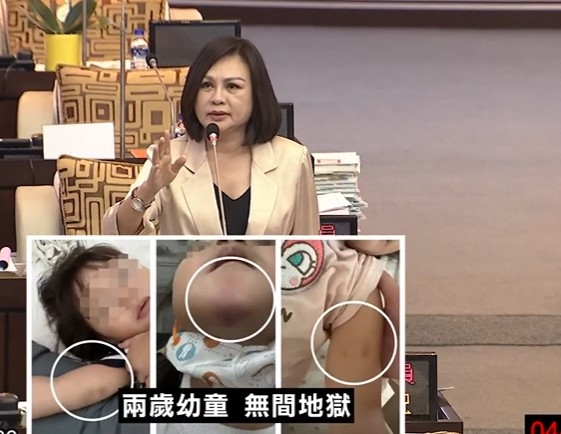 台南市議員林燕祝5日上午在市議會質詢爆料，1名女童慘遭幼兒園教保員虐待長達2個月。（圖擷取自台南市議會YT頻道）